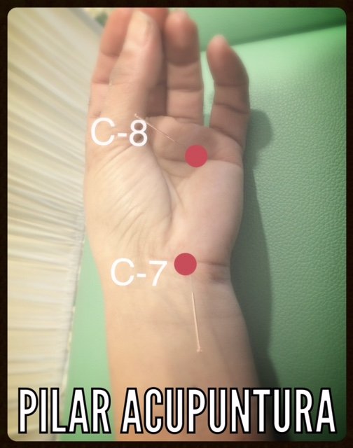 Puntos de acupuntura en la muñeca, tratamiento natural