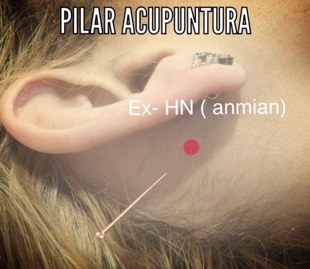 Acupuntura en la oreja para tratar el insomnio