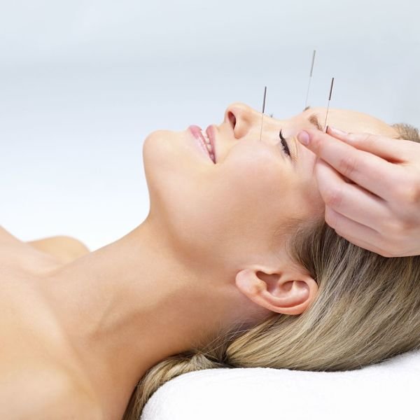 Tratamiento de acupuntura facial